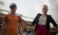 Et ungt søskendepar med albinisme poserer foran kameraet ved deres hjem i Uganda